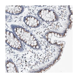 VWA5B2, Rabbit, Polyclonal Antibody, Abnova 100 &mu;L | Buy Online | Abnova Corporation | Fisher Scientific