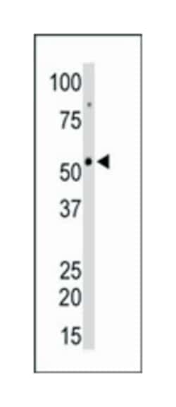 CAMK2G Rabbit anti-Human, Monkey, Mouse, Rat, Polyclonal Antibody, Abnova 400 &mu;L | Buy Online | Abnova Corporation | Fisher Scientific