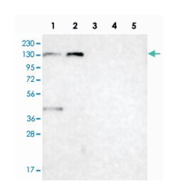 C6orf170, Rabbit, Polyclonal Antibody, Abnova 100 &mu;L | Buy Online | Abnova Corporation | Fisher Scientific