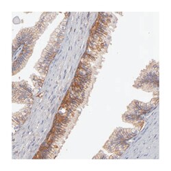 ABCC4 Rabbit anti-Human, Polyclonal Antibody, Abnova 100 &mu;L | Buy Online | Abnova Corporation | Fisher Scientific
