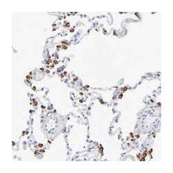 FBXO11, Rabbit, Polyclonal Antibody, Abnova 100&mu;L; Unlabeled:Antibodies,