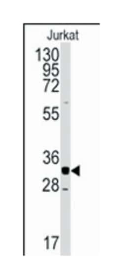 CDK2 Rabbit anti-Human, Polyclonal Antibody, Abnova 400 &mu;L | Buy Online | Abnova Corporation | Fisher Scientific