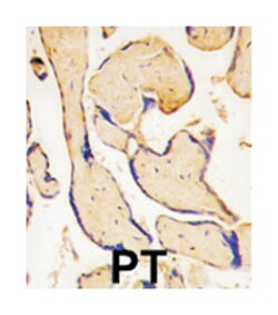 EPHA3 Rabbit anti-Hamster, Human, Polyclonal Antibody, Abnova 400&mu;L;