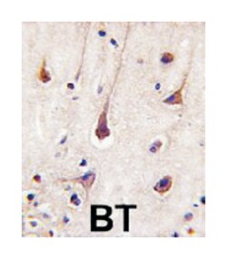 PIK3R2 Rabbit anti-Human, Polyclonal Antibody, Abnova 400 &mu;L | Buy Online | Abnova Corporation | Fisher Scientific