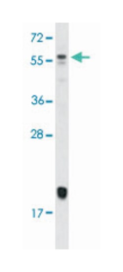 BMP10, Rabbit, Polyclonal Antibody, Abnova 400 &mu;L | Buy Online | Abnova Corporation | Fisher Scientific
