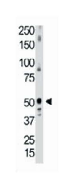 BMP5 Rabbit anti-Human, Polyclonal Antibody, Abnova 400&mu;L; Unlabeled:Antibodies,
