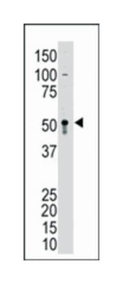 GDF2 (N-terminus), Rabbit, Polyclonal Antibody, Abnova 400&mu;L; Unlabeled:Antibodies,