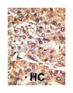 GPR37 Rabbit anti-Human, Mouse, Polyclonal Antibody, Abnova 400 &mu;L | Buy Online | Abnova Corporation | Fisher Scientific