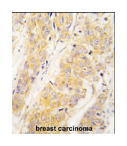 PKM2 Rabbit anti-Human, Monkey, Mouse, Rat, Polyclonal Antibody, Abnova 400 &mu;L | Buy Online | Abnova Corporation | Fisher Scientific