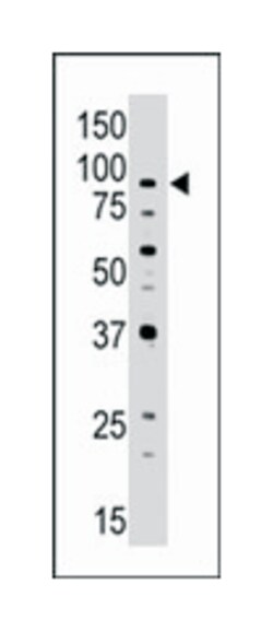 ABCB7 Rabbit anti-Human, Polyclonal Antibody, Abnova 400&mu;L; Unlabeled:Antibodies,