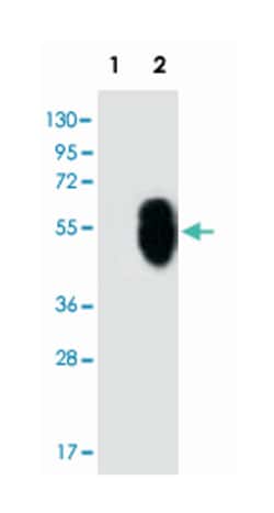 MLLT6, Rabbit, Polyclonal Antibody, Abnova 400&mu;L; Unlabeled:Antibodies,