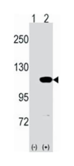 MVP Rabbit anti-Human, Polyclonal Antibody, Abnova 400 &mu;L | Buy Online | Abnova Corporation | Fisher Scientific