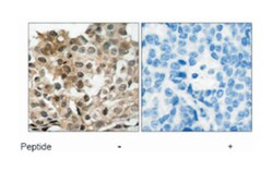 FOXO3 Rabbit anti-Human, Mouse, Rat, Polyclonal Antibody, Abnova 100&mu;g;