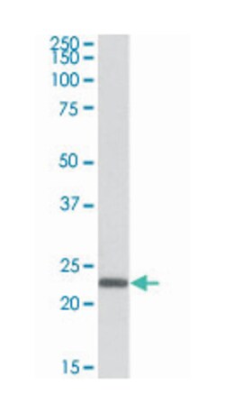 CLDN14, Goat, Polyclonal Antibody, Abnova 100 &mu;g | Buy Online | Abnova Corporation | Fisher Scientific