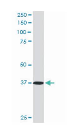 PDLIM4, Goat, Polyclonal Antibody, Abnova 100 &mu;g | Buy Online | Abnova Corporation | Fisher Scientific