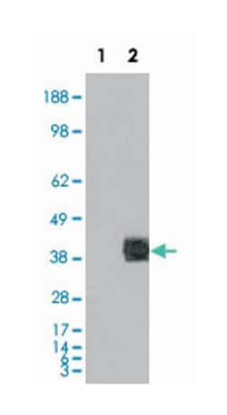 FCGR2B, Goat, Polyclonal Antibody, Abnova 100 &mu;g | Buy Online | Abnova Corporation | Fisher Scientific