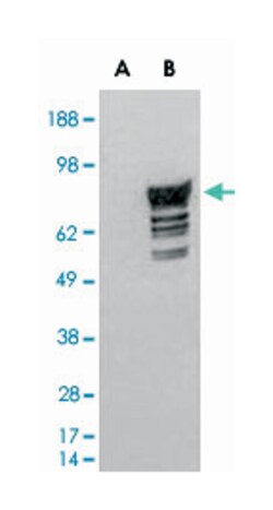 PDE4D Goat anti-Human, Mouse, Polyclonal Antibody, Abnova 100 &mu;g | Buy Online | Abnova Corporation | Fisher Scientific