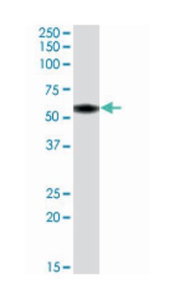 NACC1, Goat, Polyclonal Antibody, Abnova 100 &mu;g | Buy Online | Abnova Corporation | Fisher Scientific