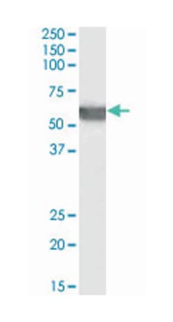 G6PD Goat anti-Human, Polyclonal Antibody, Abnova 100 &mu;g | Buy Online | Abnova Corporation | Fisher Scientific