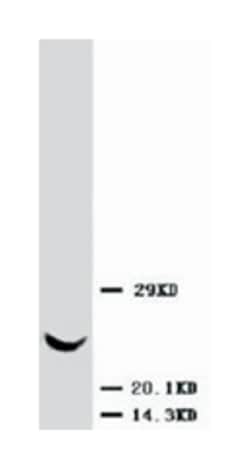 TIMP3 Rabbit anti-Human, Mouse, Rat, Polyclonal Antibody, Abnova 100&mu;g;