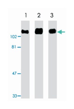 APP Rabbit anti-Human, Mouse, Rat, Polyclonal Antibody, Abnova 100&mu;g;