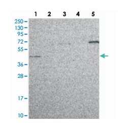 C19orf47 Rabbit anti-Human, Polyclonal Antibody, Abnova 100 &mu;L | Buy Online | Abnova Corporation | Fisher Scientific