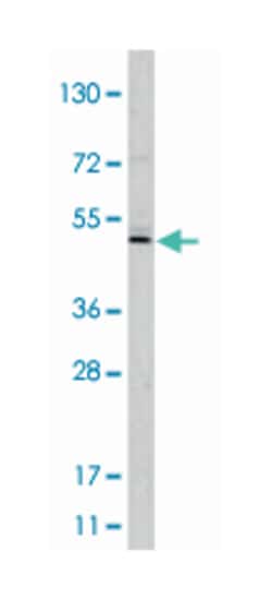 TASP1 Rabbit anti-Human, Mouse, Polyclonal Antibody, Abnova 400&mu;L; Unlabeled:Antibodies,