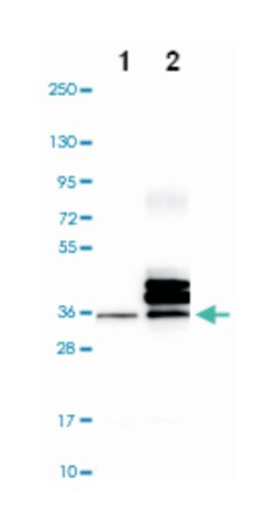 STC2 Rabbit anti-Human, Polyclonal Antibody, Abnova 100 &mu;L | Buy Online | Abnova Corporation | Fisher Scientific