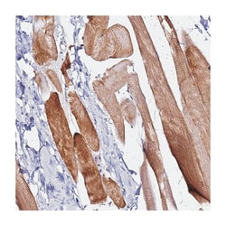 HAPLN2 Rabbit anti-Human, Polyclonal Antibody, Abnova 100 &mu;L | Buy Online | Abnova Corporation | Fisher Scientific