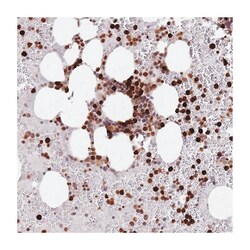 RESP18, Rabbit, Polyclonal Antibody, Abnova 100&mu;L; Unlabeled:Antibodies,
