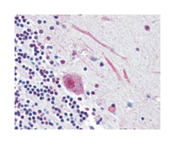 SLC5A9 Rabbit anti-Human, Monkey, Polyclonal Antibody, Abnova 50 &mu;g | Buy Online | Abnova Corporation | Fisher Scientific