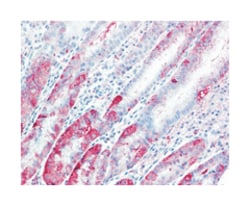 TSPAN13 Rabbit anti-Horse, Human, Monkey, Mouse, Rat, Polyclonal Antibody, Abnova 50 &mu;g | Buy Online | Abnova Corporation | Fisher Scientific