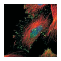 MYH7, Rabbit, Polyclonal Antibody, Abnova 100&mu;L; Unlabeled:Antibodies,