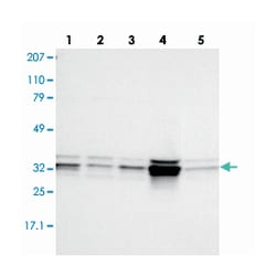MPST, Rabbit, Polyclonal Antibody, Abnova 100&mu;L; Unlabeled:Antibodies,