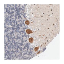 FOXO1 Rabbit anti-Human, Polyclonal Antibody, Abnova 100&mu;L; Unlabeled:Antibodies,