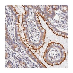 PCTK1 Rabbit anti-Human, Mouse, Rat, Polyclonal Antibody, Abnova 100&mu;L;