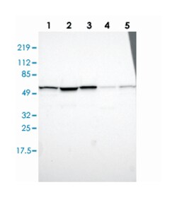 IMPDH2, Rabbit, Polyclonal Antibody, Abnova 100&mu;L; Unlabeled:Antibodies,