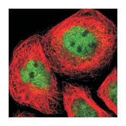 CHUK Rabbit anti-Human, Polyclonal Antibody, Abnova 100&mu;L; Unlabeled:Antibodies,