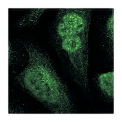 RBM39 Rabbit anti-Human, Polyclonal Antibody, Abnova 100&mu;L; Unlabeled:Antibodies,