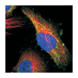 MXD1, Rabbit, Polyclonal Antibody, Abnova 100&mu;L; Unlabeled:Antibodies,