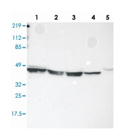 KRT18 Rabbit anti-Human, Polyclonal Antibody, Abnova 100&mu;L; Unlabeled:Antibodies,