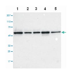 TOM1, Rabbit, Polyclonal Antibody, Abnova 100&mu;L; Unlabeled:Antibodies,