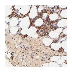 SERPINC1 Rabbit anti-Human, Polyclonal Antibody, Abnova 100 &mu;L | Buy Online | Abnova Corporation | Fisher Scientific