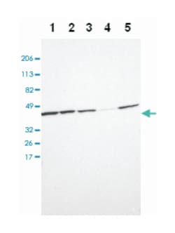 TMOD3, Rabbit, Polyclonal Antibody, Abnova 100 &mu;L | Buy Online | Abnova Corporation | Fisher Scientific