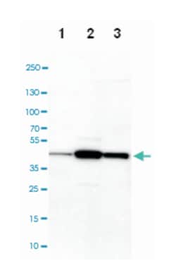 TMOD3, Rabbit, Polyclonal Antibody, Abnova 100 &mu;L | Buy Online | Abnova Corporation | Fisher Scientific