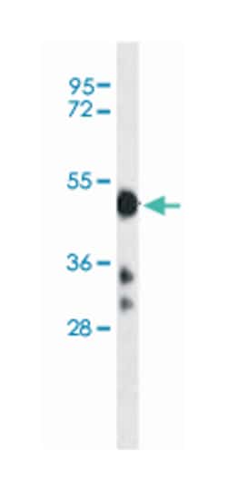 CYP2D6 Rabbit anti-Human, Polyclonal Antibody, Abnova 400 &mu;L | Buy Online | Abnova Corporation | Fisher Scientific