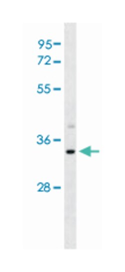 SULT1A3 Rabbit anti-Human, Polyclonal Antibody, Abnova 400&mu;L; Unlabeled:Antibodies,