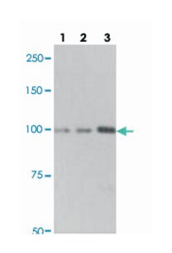 MARS, Rabbit, Polyclonal Antibody, Abnova 100 &mu;L | Buy Online | Abnova Corporation | Fisher Scientific