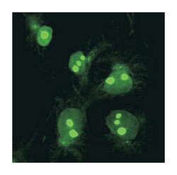 MARS, Rabbit, Polyclonal Antibody, Abnova 100 &mu;L | Buy Online | Abnova Corporation | Fisher Scientific