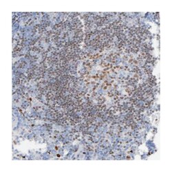 IRF8 Rabbit anti-Human, Polyclonal Antibody, Abnova 100 &mu;L | Buy Online | Abnova Corporation | Fisher Scientific